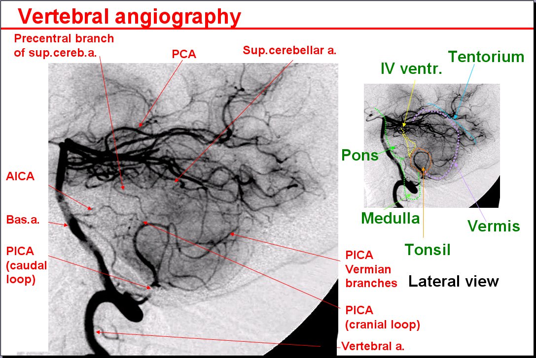 Salamons Neuroanatomy And Neurovasculature Web Atlas Resource